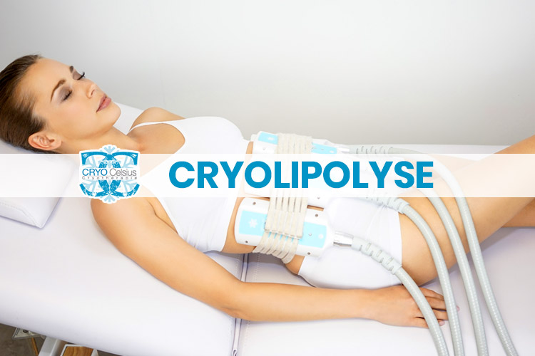 Cryolipolyse